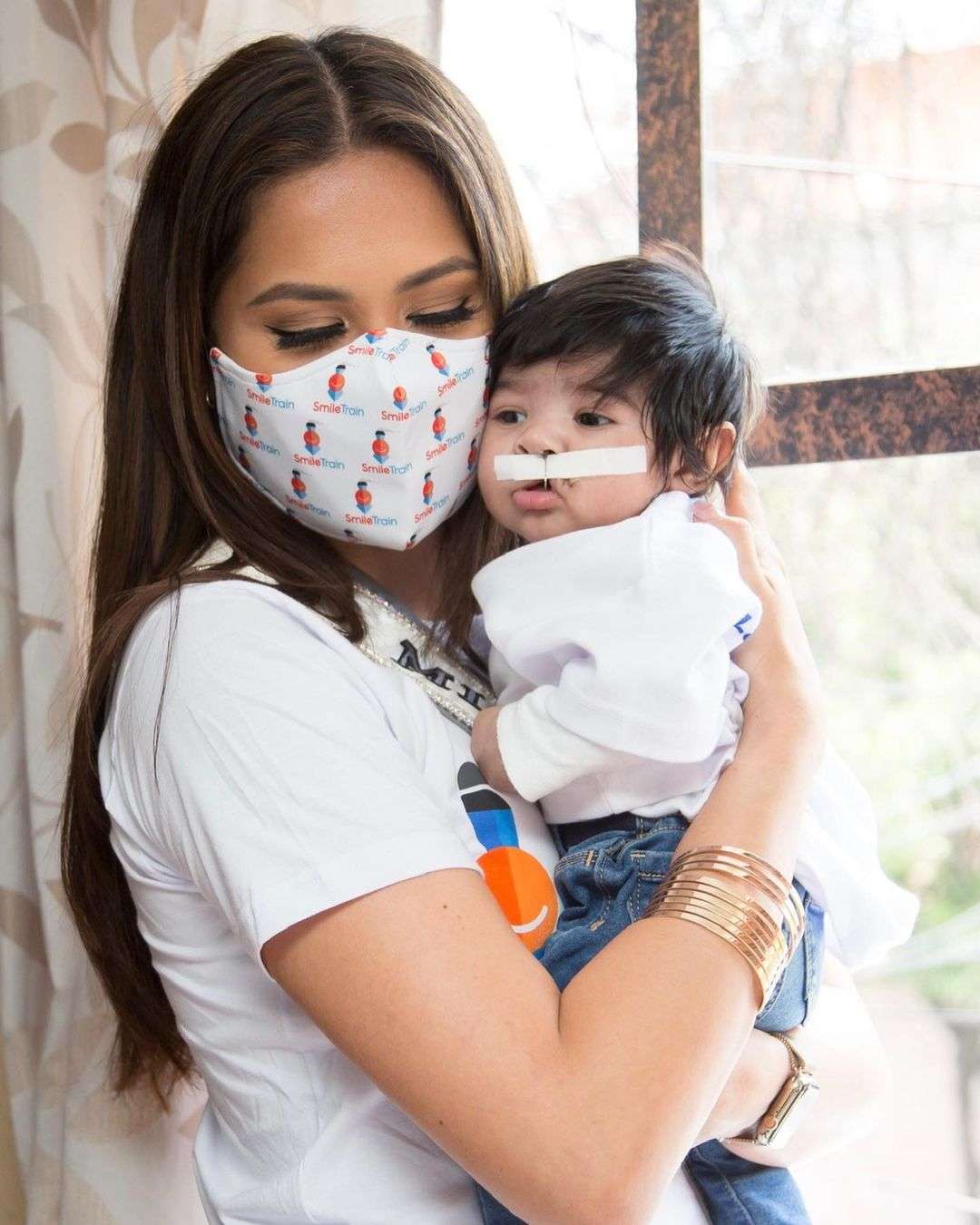 Conoce andrea meza a bebé de 3 meses con hendidura en el labio