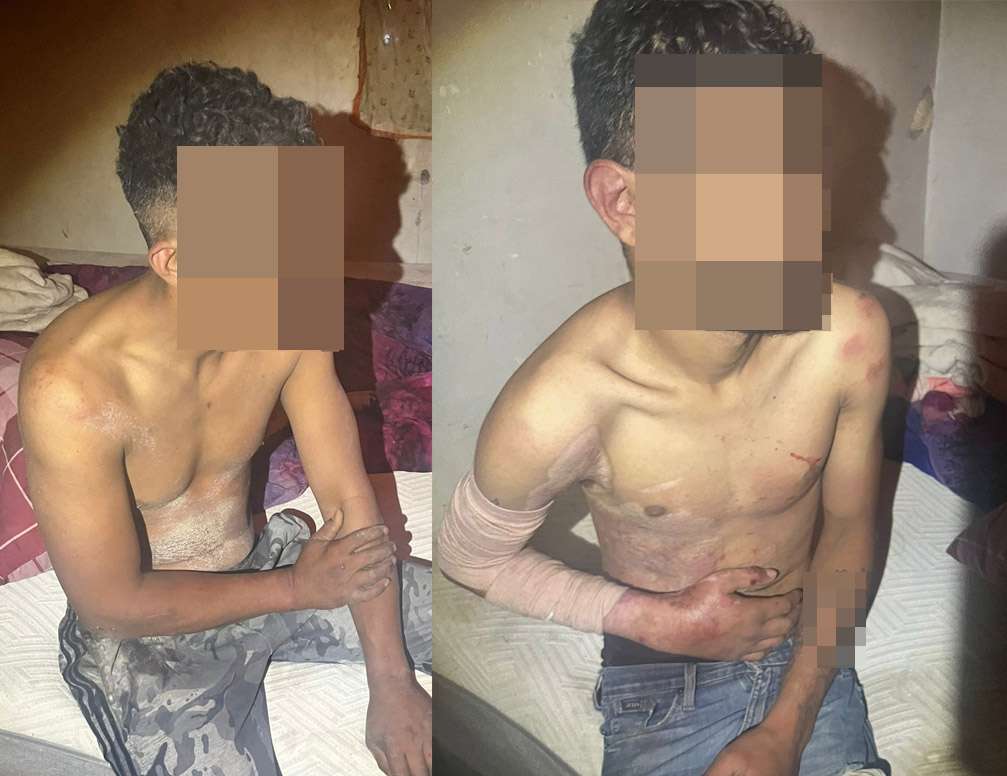 Localizan golpeados a 2 hombres que estaban secuestrados