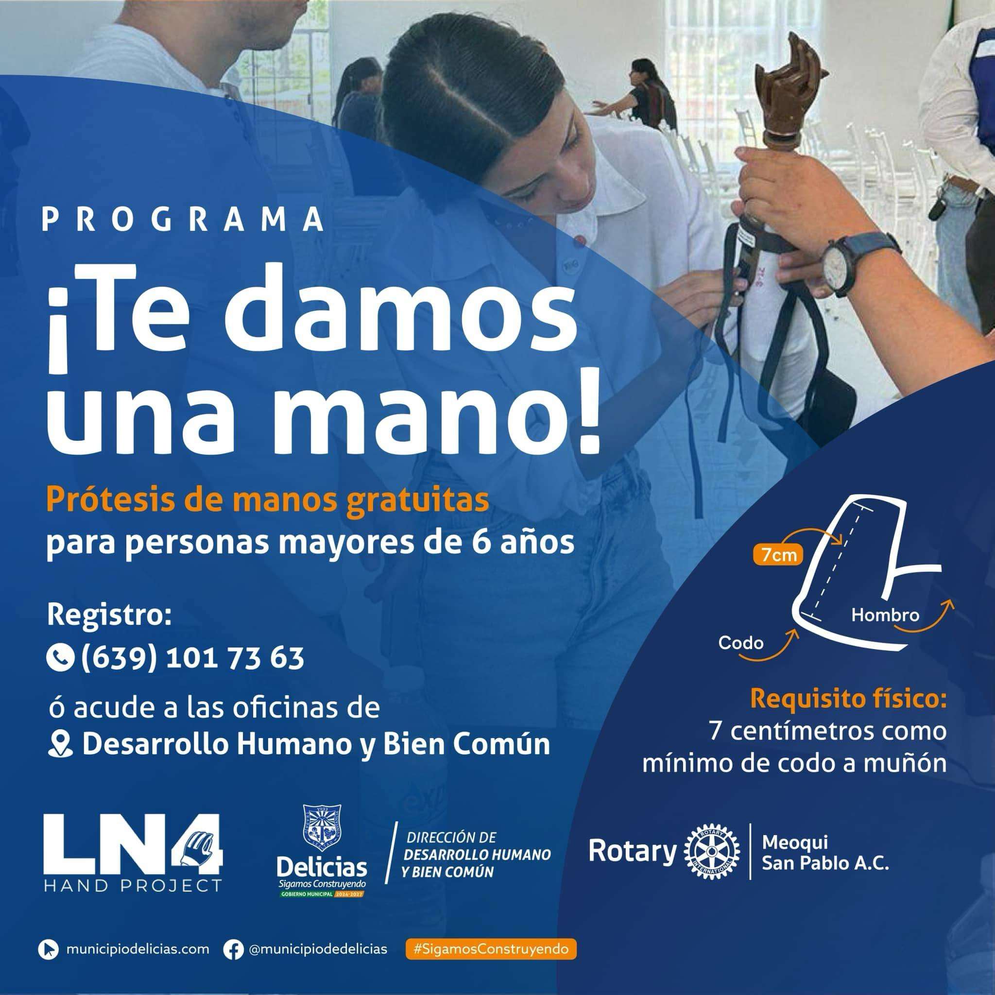 Invitan a ciudadanos de Delicias a recibir prótesis de manos gratuitas