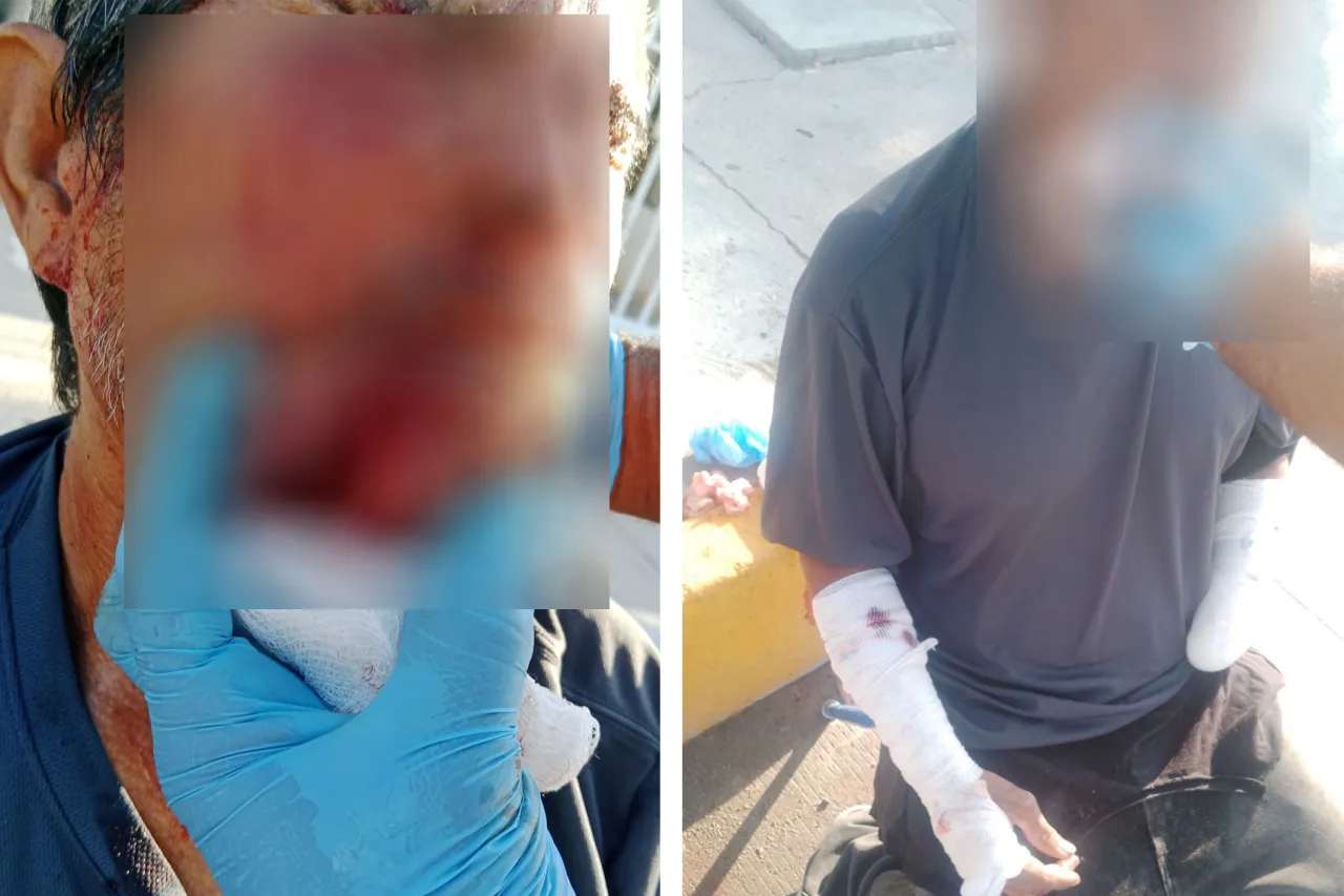 Ataca pitbull a indigente en la colonia Andrés Figueroa
