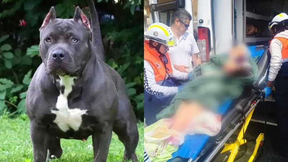 Pierde adulta mayor su brazo por ataque de pitbull 