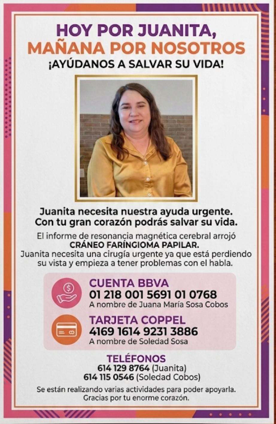 Invitan a hamburguesada con causa para apoyar la cirugía de Juanita