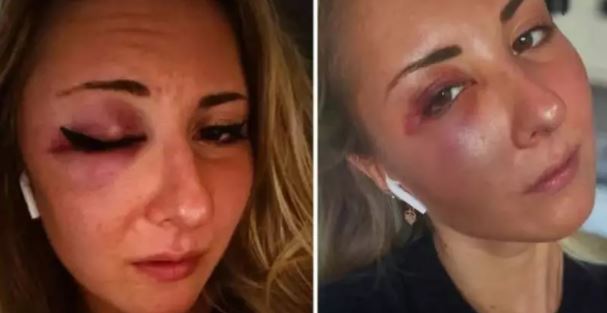 Así quedó la joven tras el ataque